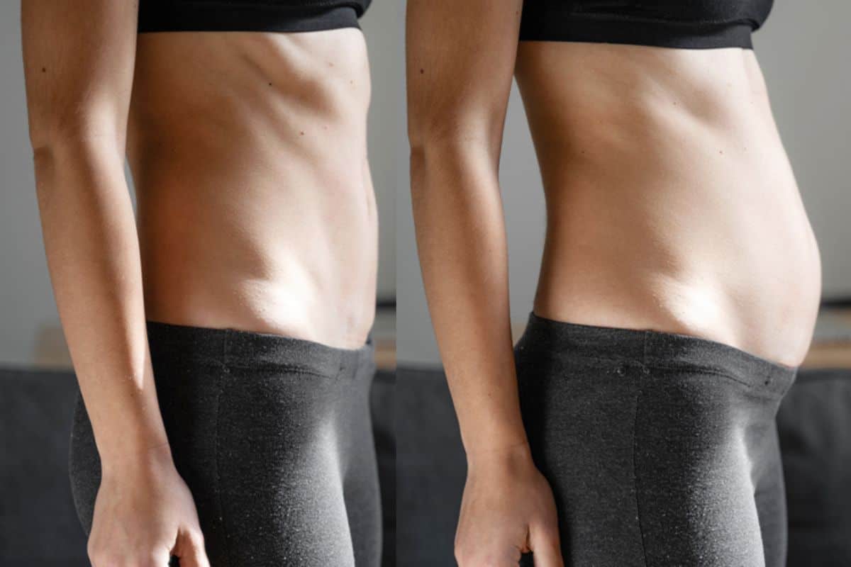 How long does diastasis recti take to improve Byfleet?
