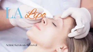 Woman receiving Actinic Keratosis Removal Treatment Byfleet