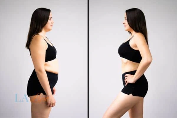 LA-EMS Body Sculpting Byfleet results before and after of womans results on body toning.