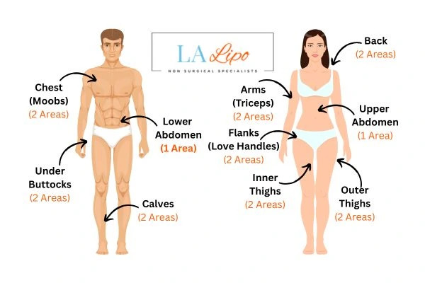 LA LIPO Cryolipolysis Areas Byfleet