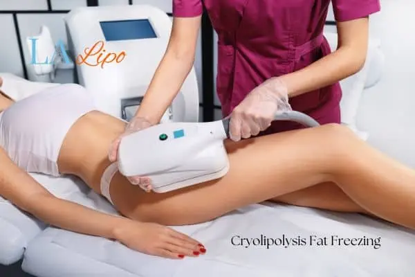 Woman receiving coolsculpting Byfleet treatment on her thighs