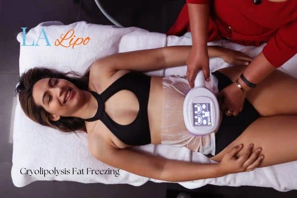 woman getting cryolipolysis Byfleet