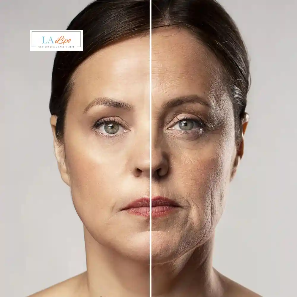 How Can You Tell If Non-Surgical Skin Tightening Is Right for You Byfleet?