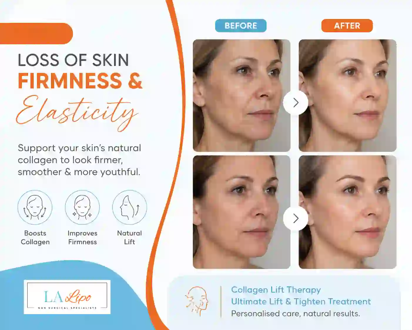Sign #7: Loss of Skin Firmness and Elasticity Byfleet