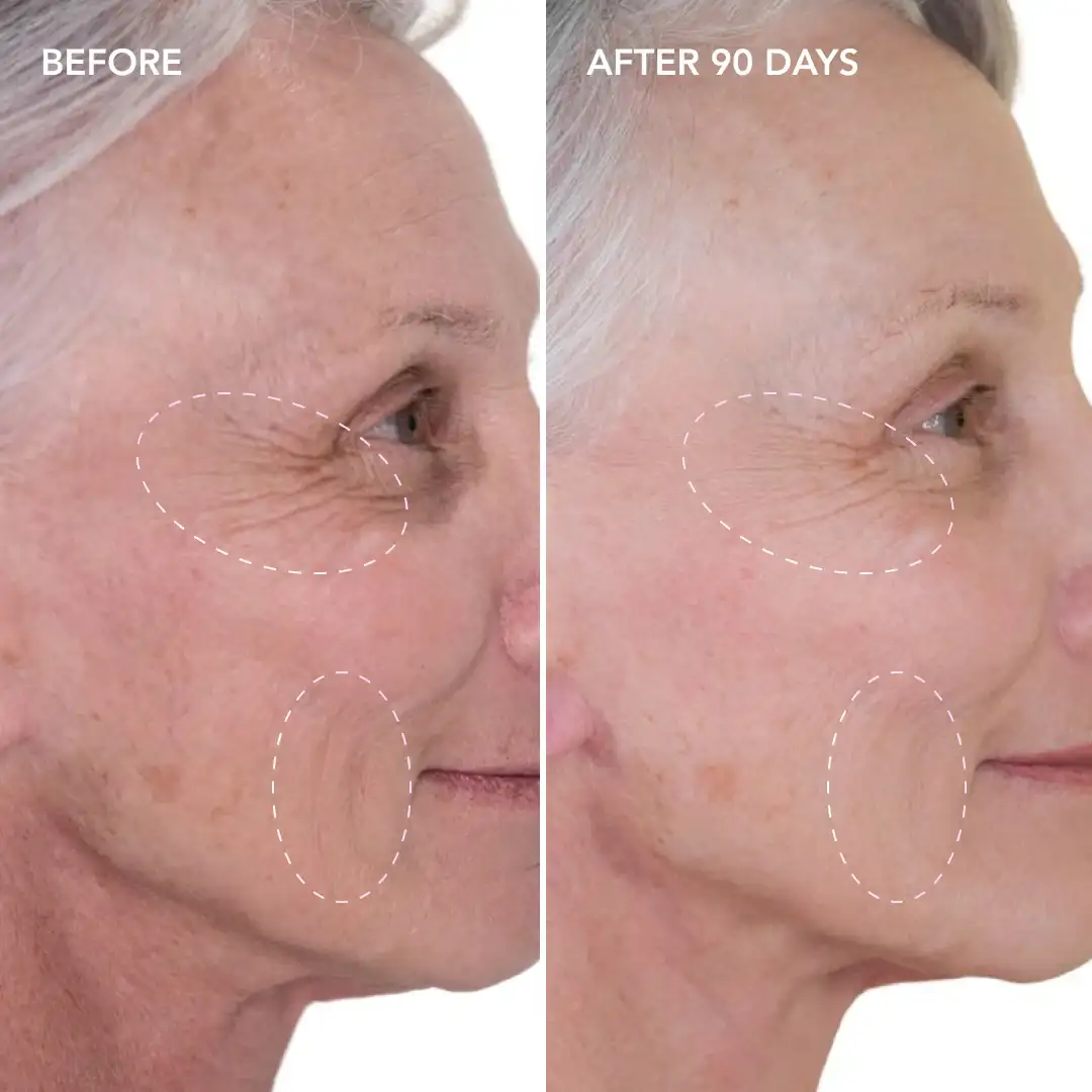 When will you see results Byfleet